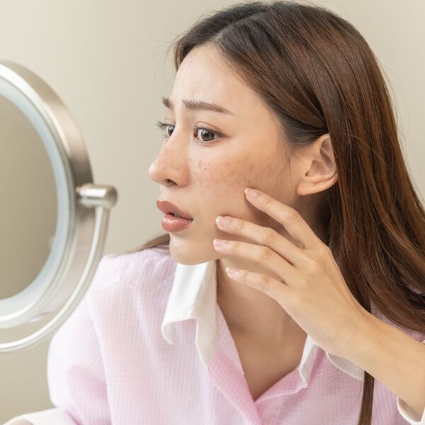 คู่มือเลือกสกินแคร์ผิวแพ้ง่าย ฟื้นฟูและปกป้องผิวอย่างอ่อนโยน