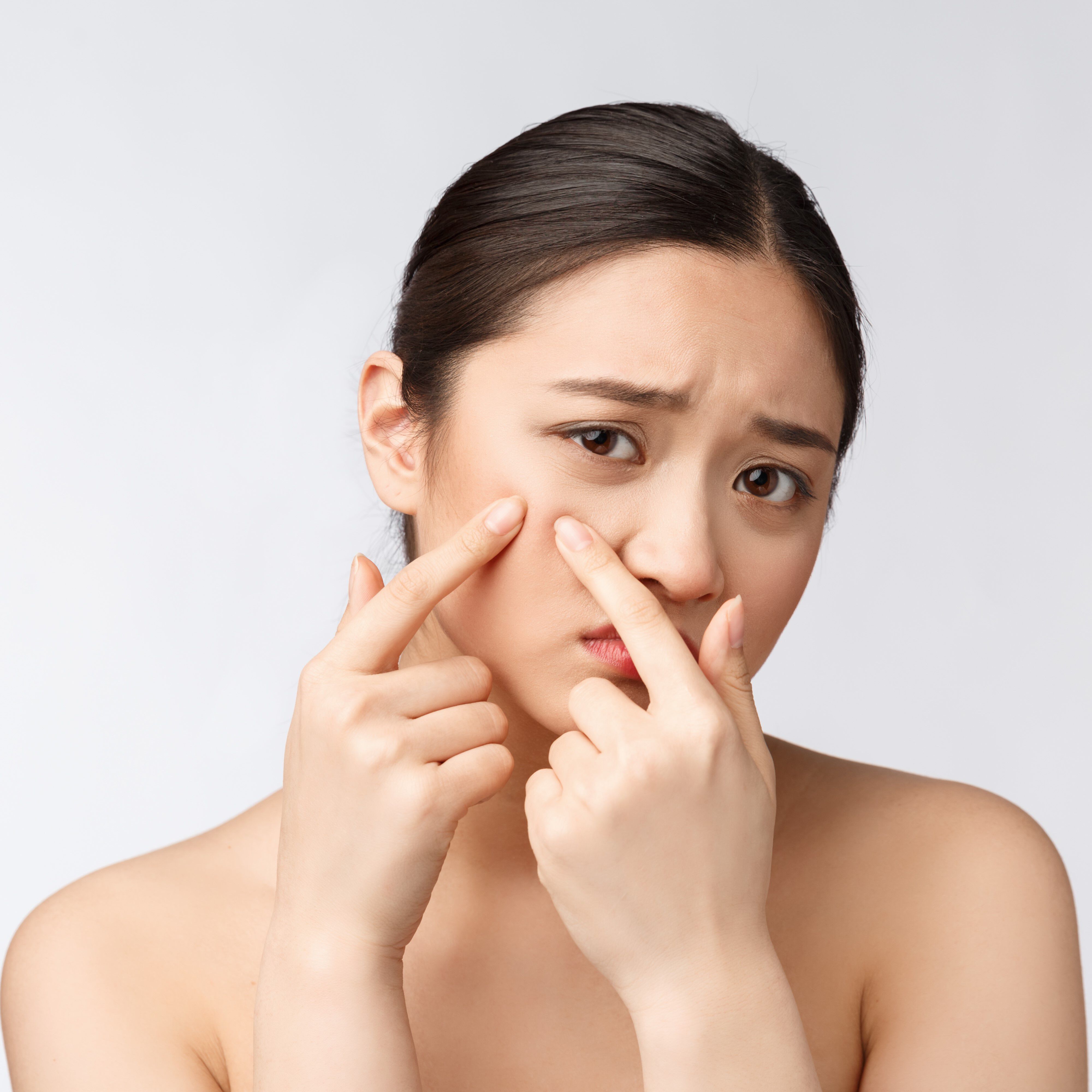 สิวอุดตันเกิดจากอะไร ? รักษาอย่างไรให้ถูกวิธี สิวอุดตันเกิดจากอะไร ? รักษาอย่างไรให้ถูกวิธี