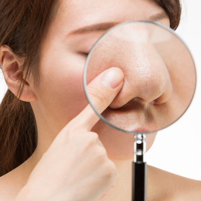 รูขุมขนกว้าง ทำไงดี ? สรุป 5 วิธีดูแลอย่างตรงจุด