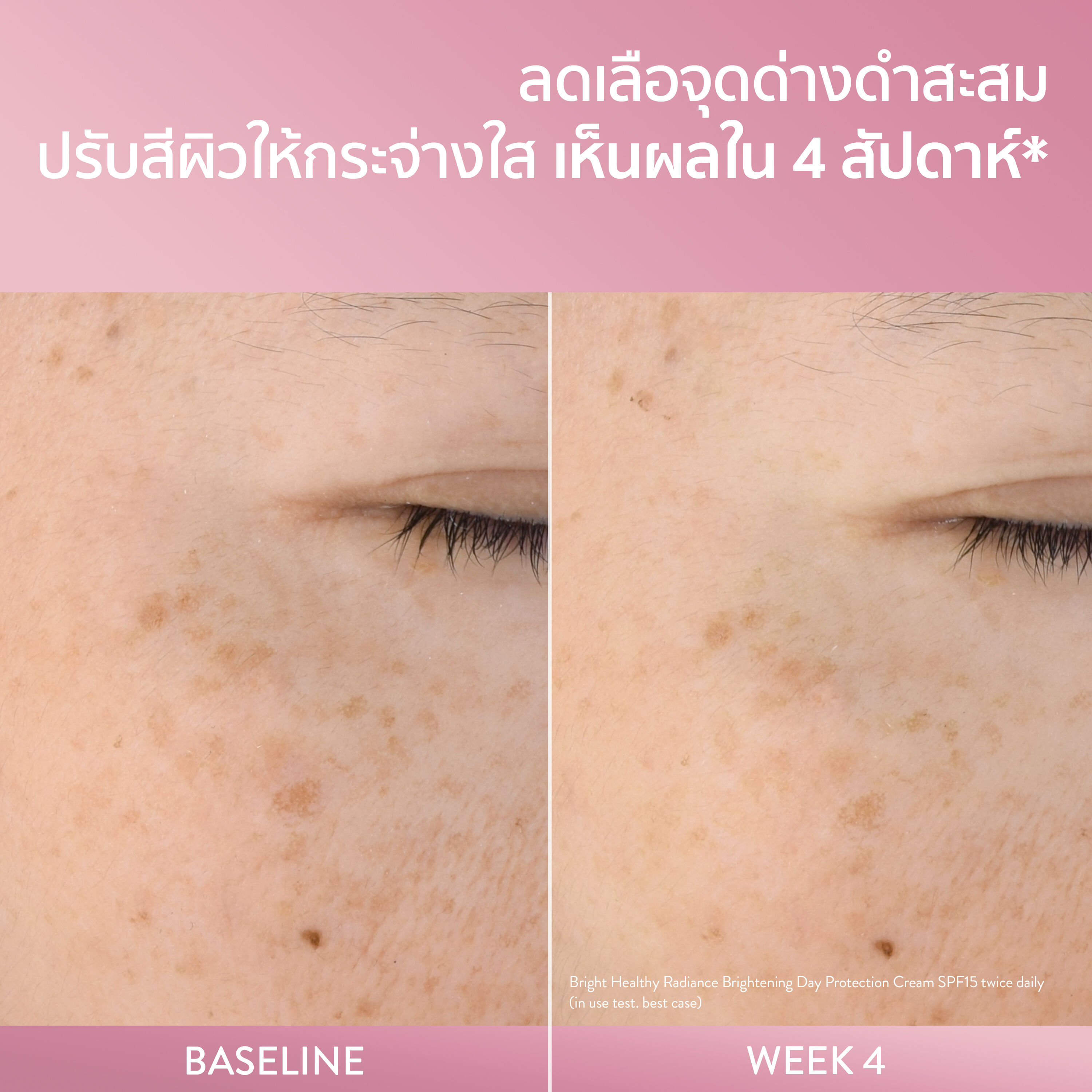 เซตาฟิล ไบรท์ เฮลธ์ตี้ เรเดียนซ์ ไบรท์เทนนิ่ง ไนท์ คอมฟอร์ท ครีม